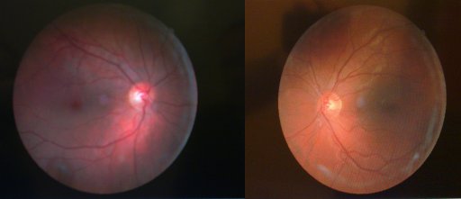 Retinal images